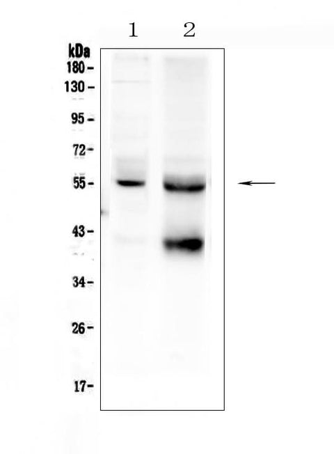 Anti-TGF beta Receptor I/TGFBR1 Antibody Picoband® Boster Bio