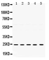 Anti-TIMP2 Antibody Picoband® Boster Bio