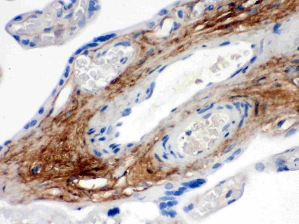 Anti-TNXB Antibody Picoband® Boster Bio