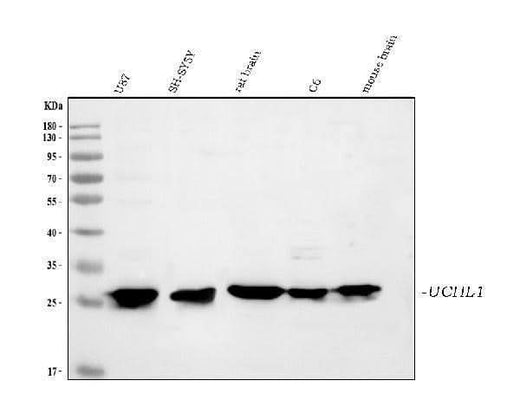 Anti-PGP9.5/UCHL1 Antibody Picoband® Boster Bio