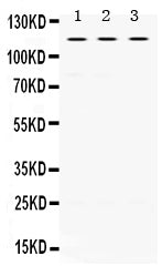 Anti-UNC5C Antibody Picoband® Boster Bio