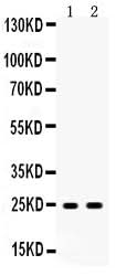 Anti-Apolipoprotein A I/APOA1 Antibody Picoband® Boster Bio