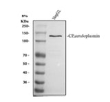 Anti-Ceruloplasmin/CP Antibody Picoband® Boster Bio