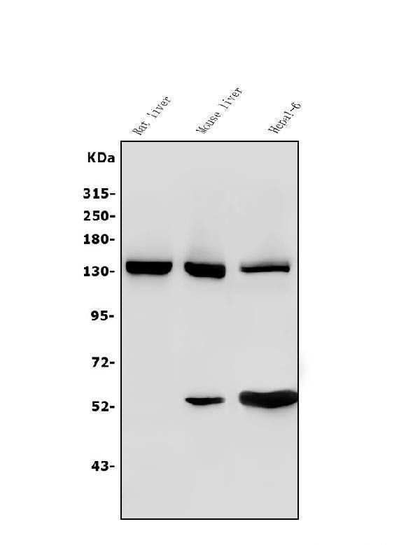 Anti-Ceruloplasmin/CP Antibody Picoband® Boster Bio
