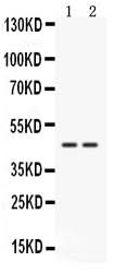 Anti-Cathepsin K/CTSK Antibody Picoband® Boster Bio