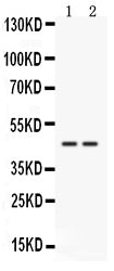 Anti-Cathepsin K/CTSK Antibody Picoband® Boster Bio