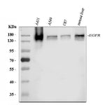 Anti-EGFR Antibody Picoband® Boster Bio