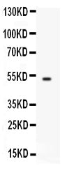 Anti-FCGRT Antibody Picoband® Boster Bio