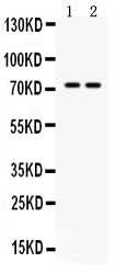 Anti-MDMX/MDM4 Antibody Picoband® Boster Bio