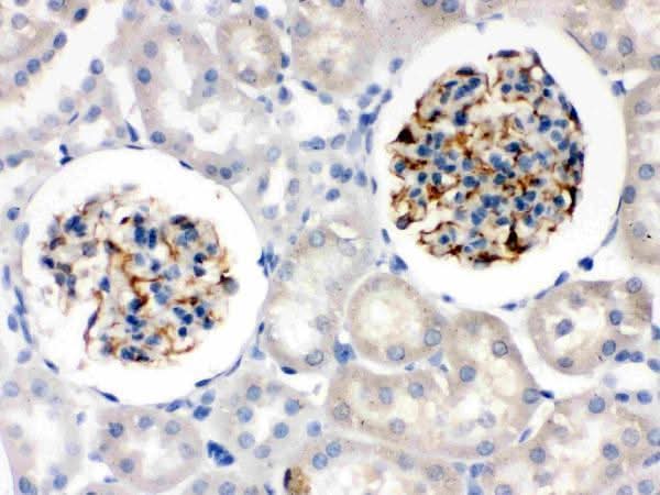 Anti-Nestin Antibody Picoband® Boster Bio