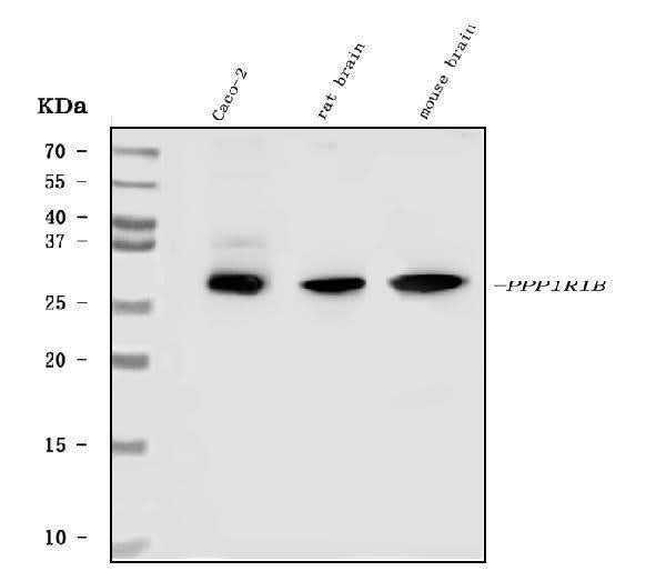 Anti-DARPP32/PPP1R1B Antibody Picoband® Boster Bio