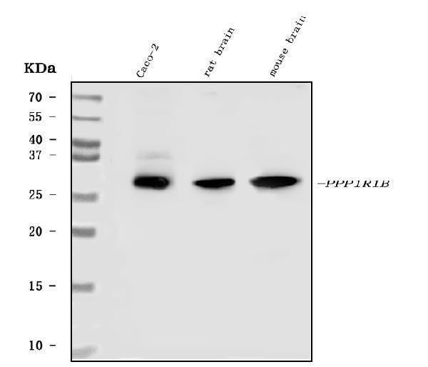 Anti-DARPP32/PPP1R1B Antibody Picoband® Boster Bio