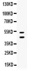 Anti-EPCR/CD201/PROCR Antibody Picoband® Boster Bio