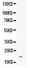 Anti-Prokineticin 1/PROK1 Antibody Picoband® Boster Bio