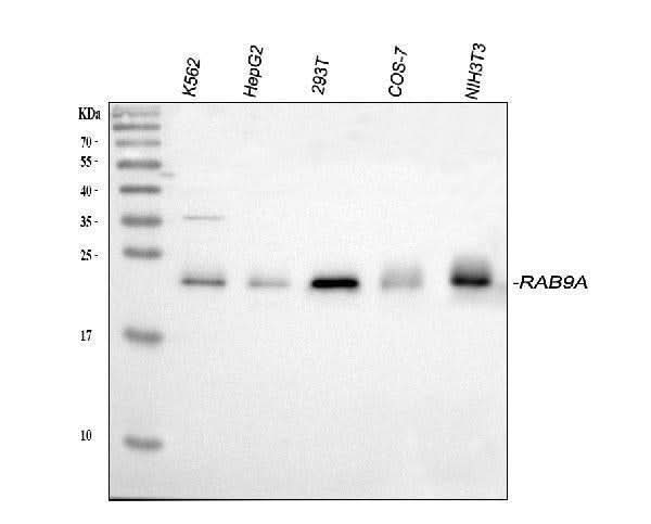 Anti-Rab9/RAB9A Antibody Picoband® Boster Bio