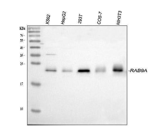 Anti-Rab9/RAB9A Antibody Picoband® Boster Bio