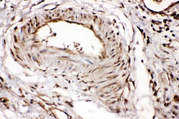 Anti-Ribonuclease Inhibitor/RNH1 Antibody Picoband® Boster Bio