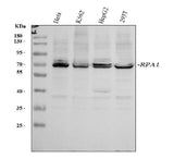 Anti-RPA70/RPA1 Antibody Picoband® Boster Bio