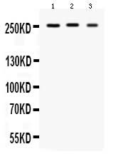 Anti-Scn1a Antibody Picoband® Boster Bio