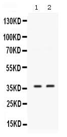 Anti-SIX1 Antibody Picoband® Boster Bio