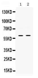 Anti-SKAP55/SKAP1 Antibody Picoband® Boster Bio