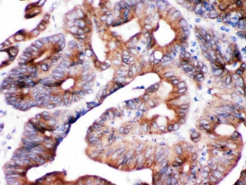 Anti-SPTLC1 Antibody Picoband® Boster Bio