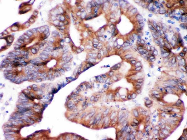 Anti-SPTLC1 Antibody Picoband® Boster Bio