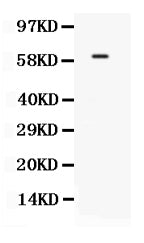 Anti-TCF7L1 Antibody Picoband® Boster Bio