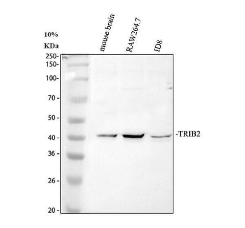 Anti-TRIB2 Antibody Picoband® Boster Bio