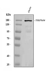 Anti-TRPM4 Antibody Picoband® Boster Bio