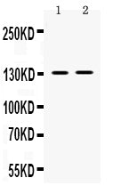 Anti-TRPM5 Antibody Picoband® Boster Bio