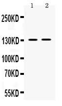 Anti-TRPM5 Antibody Picoband® Boster Bio