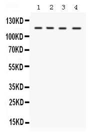 Anti-E1 Ubiquitin Activating Enzyme/UBA1 Antibody Picoband® Boster Bio