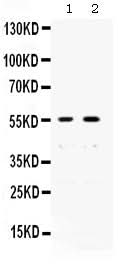 Anti-XRCC4 Antibody Picoband® Boster Bio