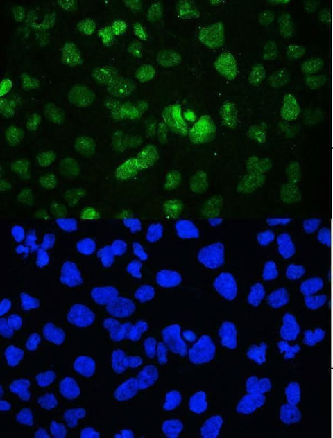 Anti-YY1 Antibody Picoband® Boster Bio