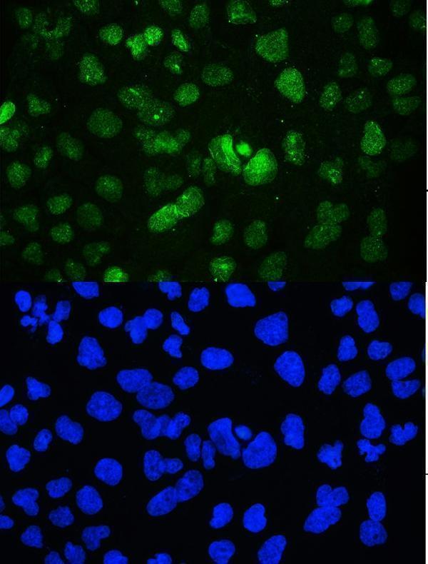 Anti-YY1 Antibody Picoband® Boster Bio