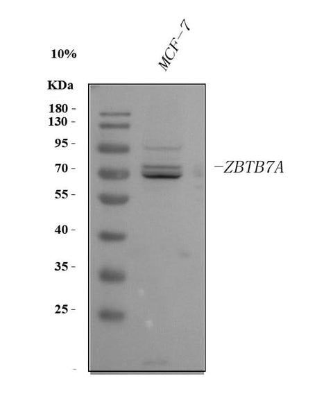 Anti-ZBTB7A Antibody Picoband® Boster Bio