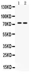 Anti-ZBTB7A Antibody Picoband® Boster Bio