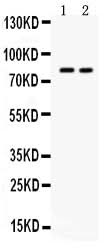 Anti-ZP2 Antibody Picoband® Boster Bio
