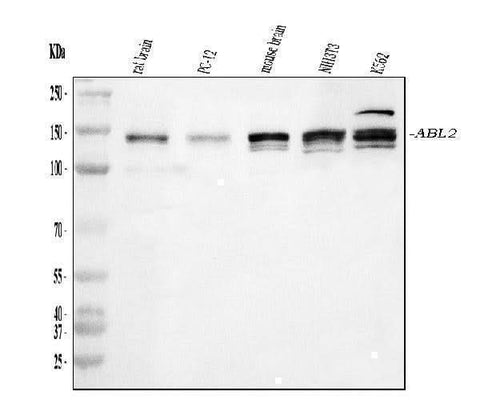 Anti-ABL2 Antibody Picoband® Boster Bio