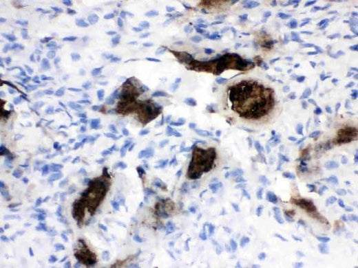 Anti-Osteocalcin/BGLAP Antibody Boster Bio