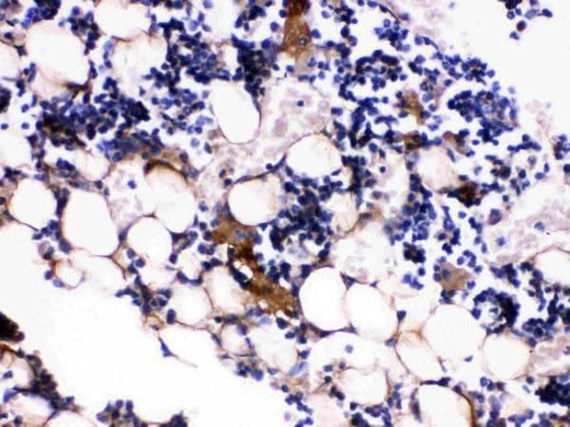 Anti-Osteocalcin/BGLAP Antibody Boster Bio