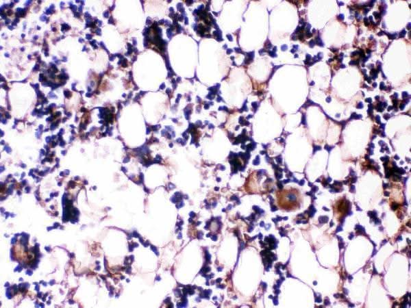 Anti-Osteocalcin/BGLAP Antibody Boster Bio