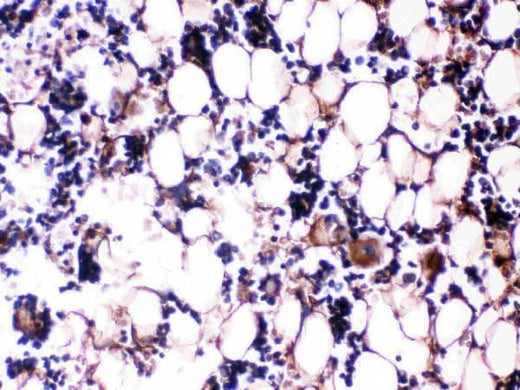 Anti-Osteocalcin/BGLAP Antibody Boster Bio