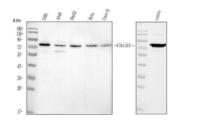 Anti-Caldesmon/CALD1 Antibody Picoband® Boster Bio