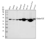 Anti-Catalase Antibody Picoband® Boster Bio
