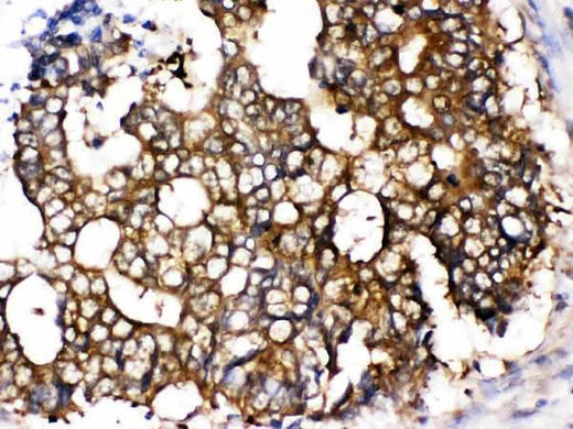 Anti-TCP1 epsilon/CCT5 Antibody Picoband® Boster Bio