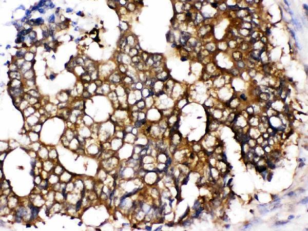 Anti-TCP1 epsilon/CCT5 Antibody Picoband® Boster Bio