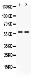 Anti-CD2/CD2 Antibody Picoband® Boster Bio