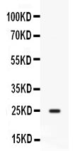 Anti-CD9 Antibody Picoband® Boster Bio